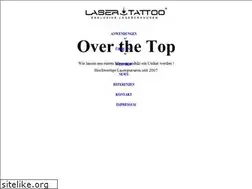 Sites similar to laser-tattoo.de