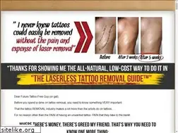Sites similar to laserlesstattooremoval.com