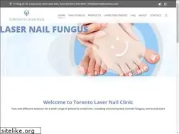 Sites similar to lasernailtoronto.com