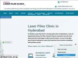 Sites similar to laserpiles.com