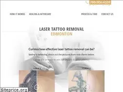 Sites similar to lasertattooremovaledmonton.com