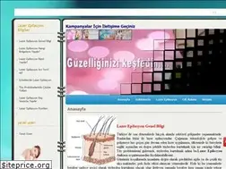Sites similar to lazerepiilasyon.com