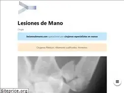 Sites similar to lesionesdemano.com