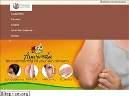 Sites similar to leucodermatreatment.com
