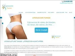 Sites similar to liposuccion-tunisie.org