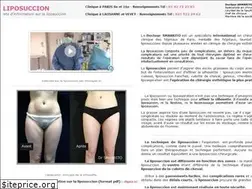 Sites similar to liposuccion.fr