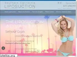 Sites similar to liposuction-southern-california.com