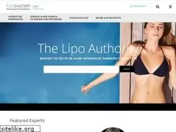 Sites similar to liposuction.com