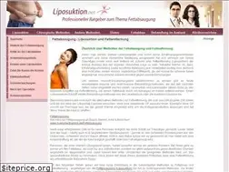 Sites similar to liposuktion.net