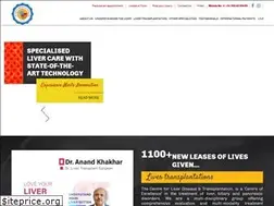 Sites similar to livertransplant.org