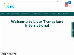Sites similar to livertransplantinternational.com