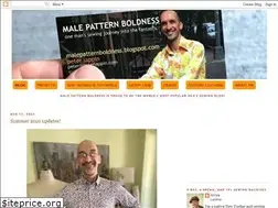Sites similar to malepatternboldness.blogspot.com