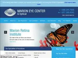 Sites similar to marioneye.com