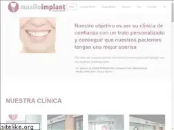 Sites similar to maxiloimplant.es