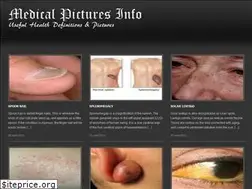 Sites similar to medicalpicturesinfo.com