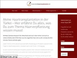 Sites similar to meinehaartransplantation.net