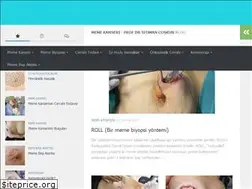 Sites similar to memekanseri.info
