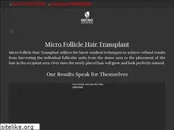 Sites similar to microfolliclehairtransplant.com