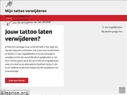 Sites similar to mijntattooverwijderen.nl