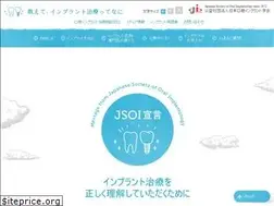 Sites similar to min-implant.jp