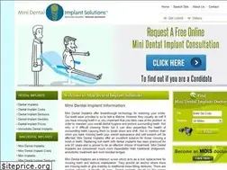 Sites similar to minidentalimplantsolutions.com