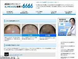 Sites similar to minoxidil-effects.com
