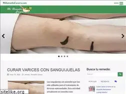Sites similar to miremediocasero.com