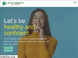 Sites similar to moleremovallosangeles.com