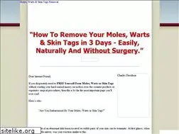 Sites similar to moleswartsremoval.com