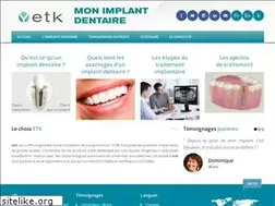 Sites similar to mon-implant-dentaire.fr