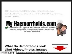 Sites similar to myhaemorrhoids.com