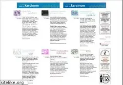 Sites similar to nadory.cz