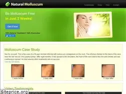 Sites similar to naturalmolluscum.com