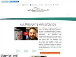 Sites similar to naturaltransplants.com