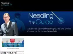 Sites similar to needlingguide.com