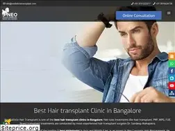 Sites similar to neofollicletransplant.com
