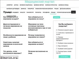 Sites similar to netpryshhei.ru