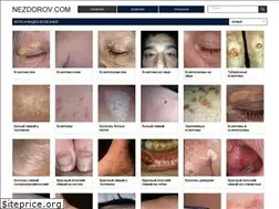 Sites similar to nezdorov.com