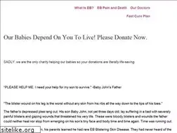 Sites similar to nobabyblisters.org