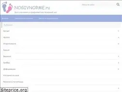 Sites similar to nogivnorme.ru