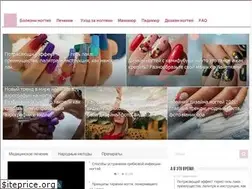 Sites similar to nogotochie.ru