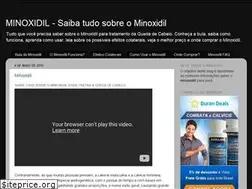 Sites similar to o-minoxidil.blogspot.com