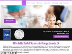 Sites similar to ocdentalimplants4u.com