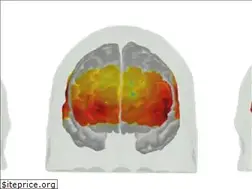 Sites similar to openfnirs.org