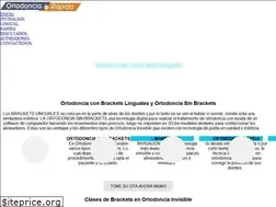 Sites similar to ortodonciainvisible.co