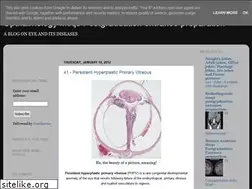 Sites similar to ouropthalmology.blogspot.com