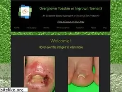 Sites similar to overgrowntoeskin.ca