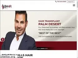 Sites similar to palmdeserthairtransplant.com