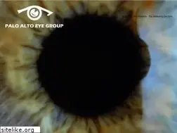 Sites similar to paloaltoeye.com