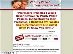 Sites similar to pearlypapulesremoval.net